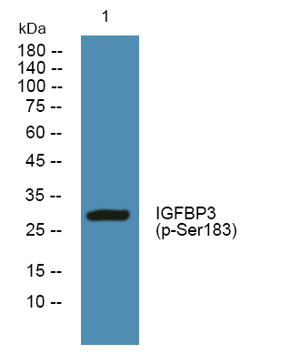 IGFBP-3 (Phospho-Ser183) Antibody