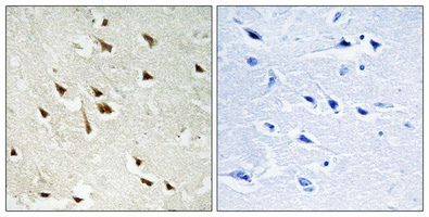 GRF-1 (Phospho-Tyr1105) Antibody