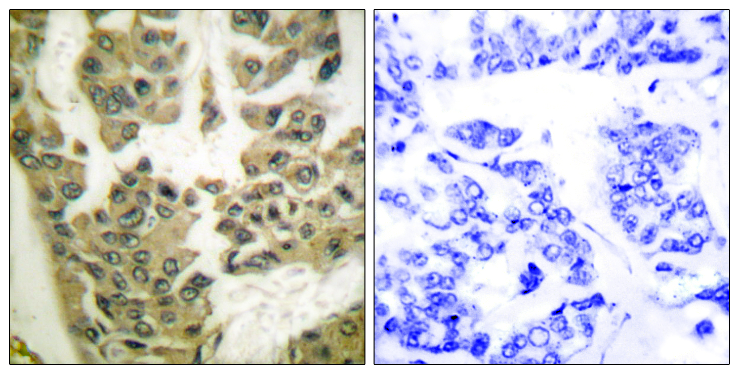 GRF-1 (Phospho-Tyr1105) Antibody