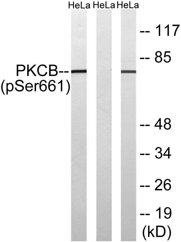 PKC β (Phospho-Ser660) Antibody