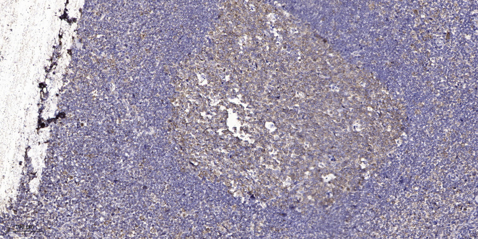 ASF1B Antibody