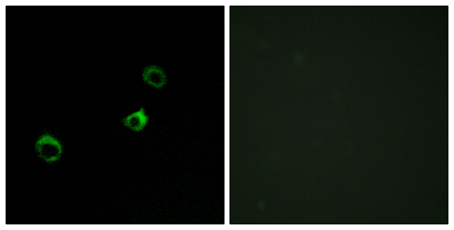 CYB561D1 Antibody