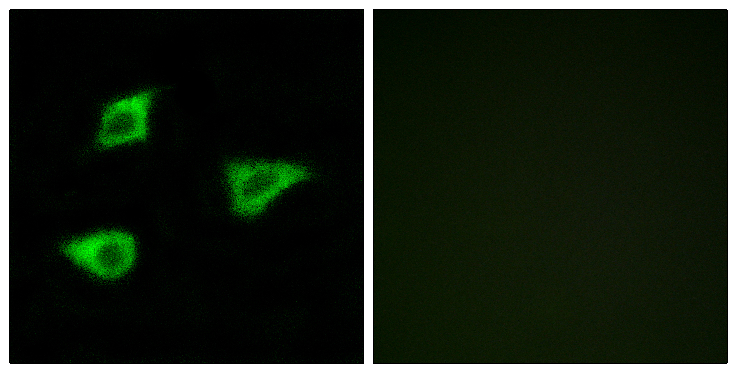 mAChR M4 Antibody