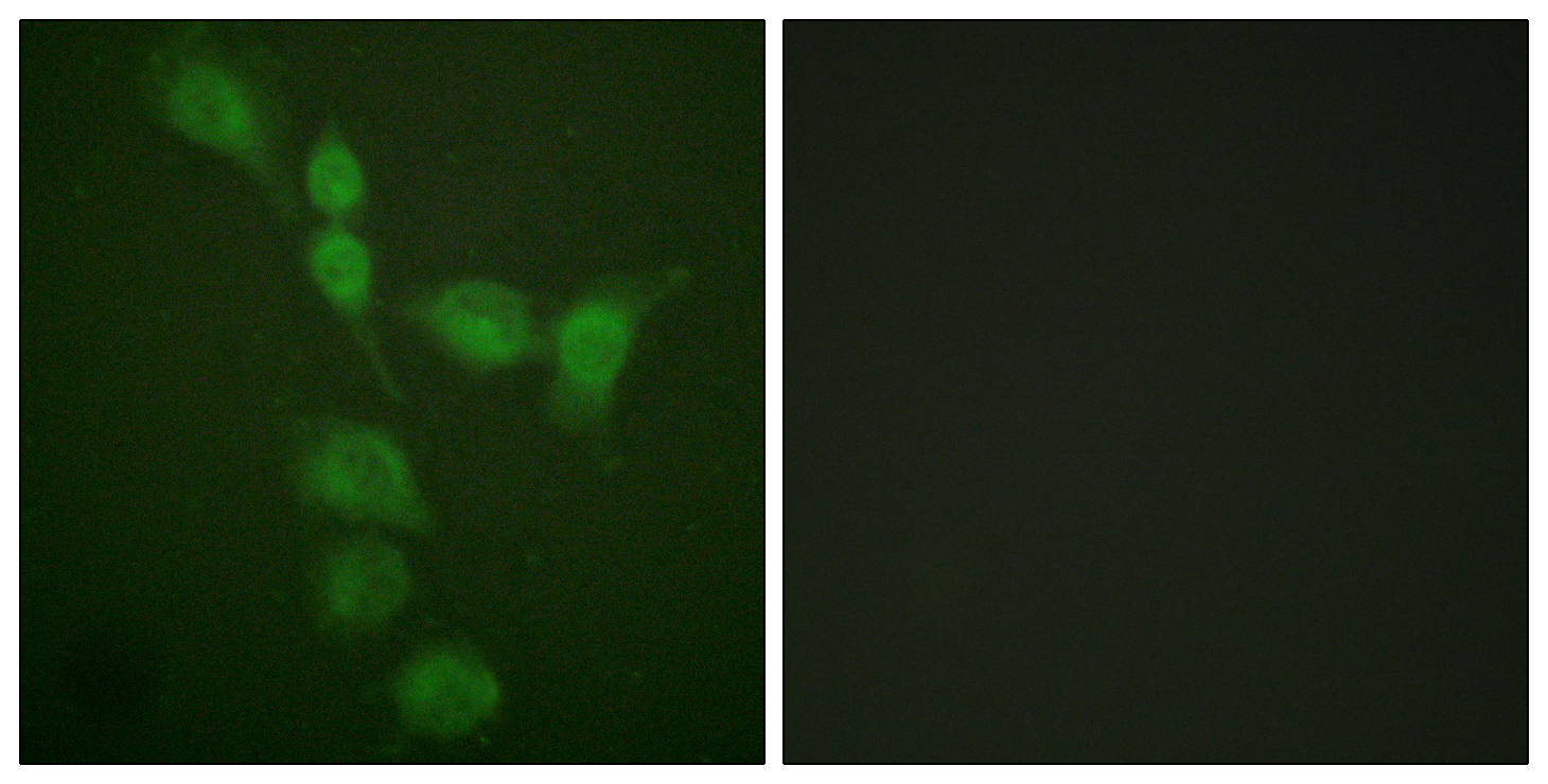 PKAalpha/beta/gamma cat Antibody