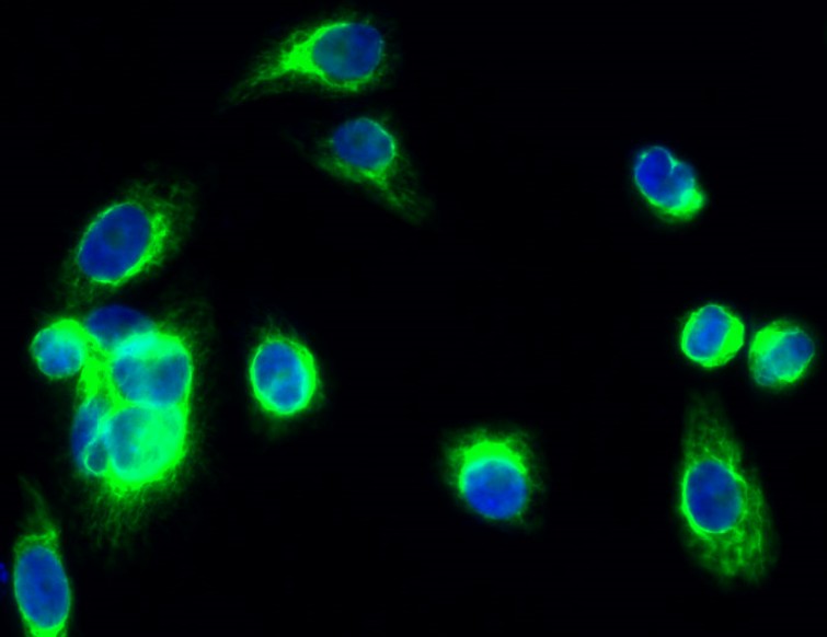 PKAalpha/beta/gamma cat Antibody