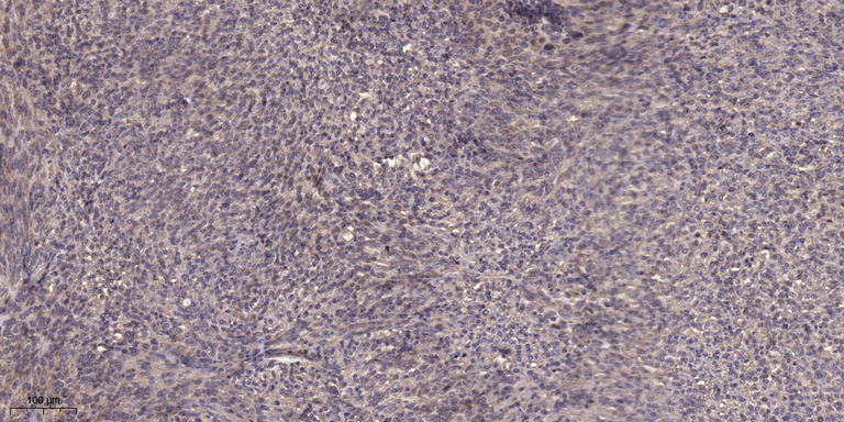 TBL2 Antibody