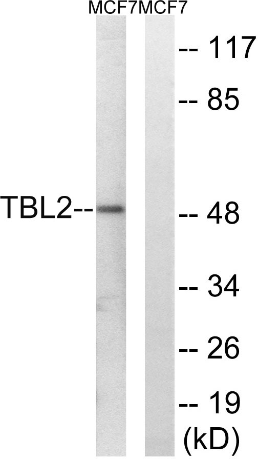 TBL2 Antibody