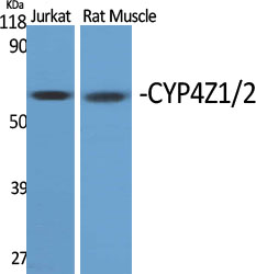 Cytochrome P450 4Z1/2 Antibody