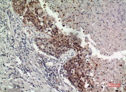 GPR87/GPR95 Antibody