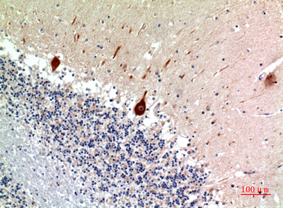 NODAL Antibody