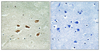 CDK5R2 Antibody