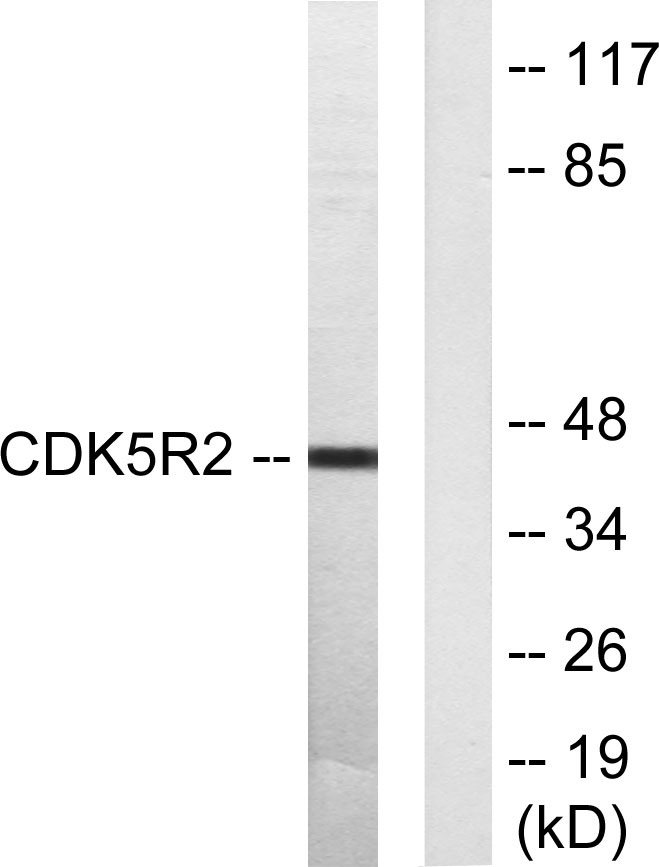 CDK5R2 Antibody