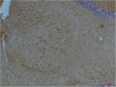 KCNH7 Antibody