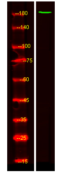 ZNF262 Antibody