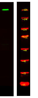 MRCKG Antibody