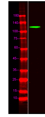 ZFPM1 Antibody