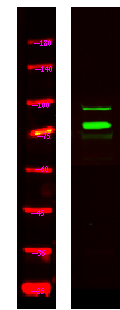 TSYL2 Antibody