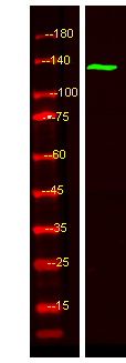 TAOK2 Antibody