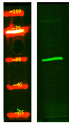 Cytochrome P450 4F22 Antibody