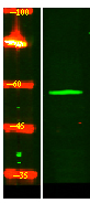 IFIT1B Antibody