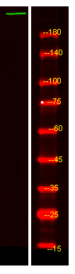 CCDC131 Antibody