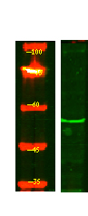 ENDOD1 Antibody