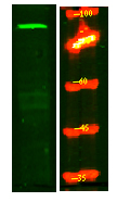 MPHOSPH8 Antibody