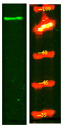 SLC9A2 Antibody