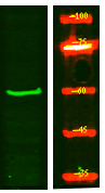 TIGD2 Antibody