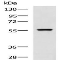 SLC5A5 Antibody