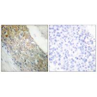 Insulin R Polyclonal Antibody