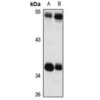 SLC7A11 Antibody