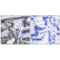 Cleaved Caspase-7 (Asp198) Antibody