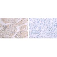 CIDEC Antibody