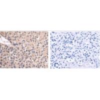 EPDR1 Antibody