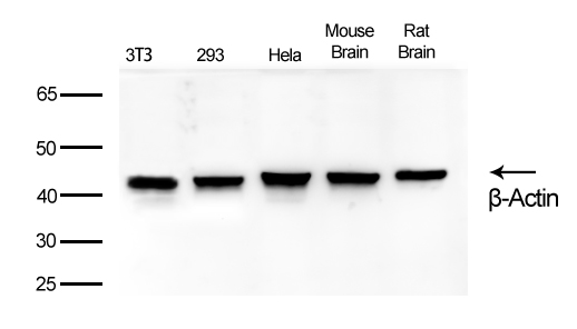 β-Actin Rabbit mAb