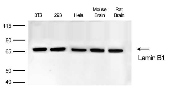 Lamin B1 Rabbit mAb