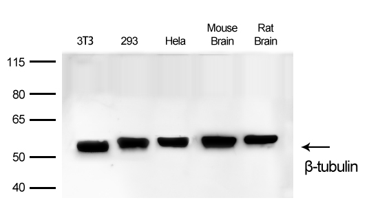 β-Tubulin Rabbit mAb