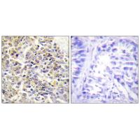 ASC Polyclonal Antibody