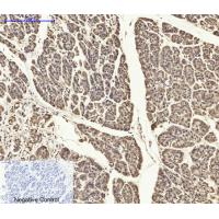 ASC Polyclonal Antibody