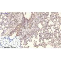 Collagen IV mouse Monoclonal Antibody