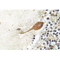 Chr-A Polyclonal Antibody