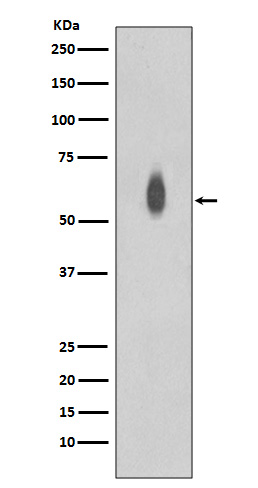 c-Myc (Phospho-Thr58/Ser62) Rabbit mAb