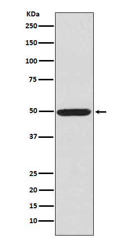 PKA R2 (Phospho-Ser99) Rabbit mAb