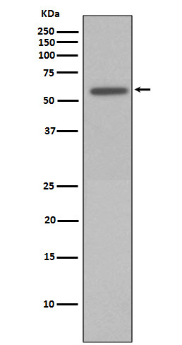 Vimentin (Phospho-Ser72) Rabbit mAb