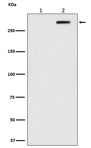 ATM (Phospho-Ser1981) Rabbit mAb