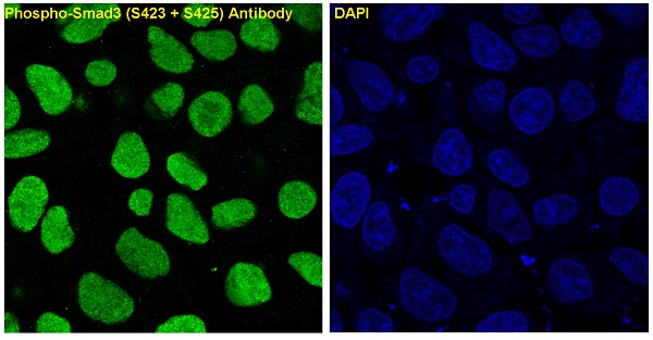 Smad3 (Phospho-Ser423/Ser425) Rabbit mAb