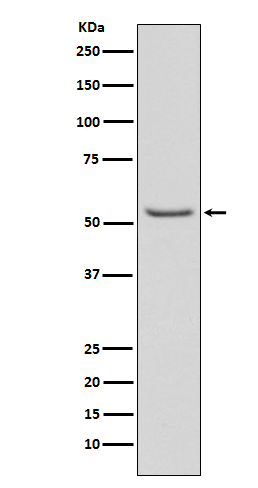 Smad3 (Phospho-Ser423/Ser425) Rabbit mAb