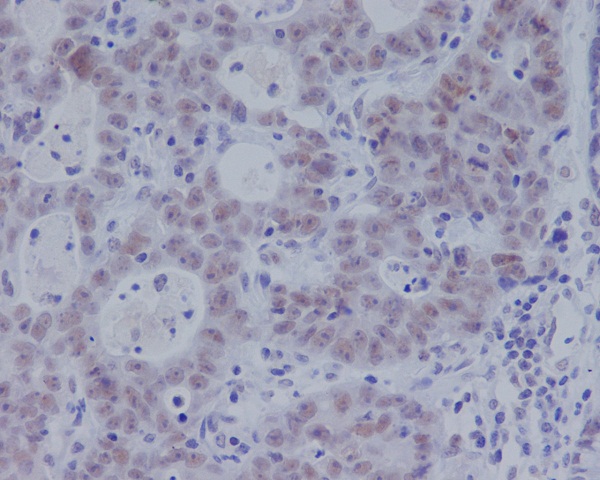 Smad3 (Phospho-Ser423/Ser425) Rabbit mAb