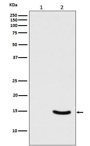 alpha Synuclein (Phospho-Ser129)  Rabbit mAb